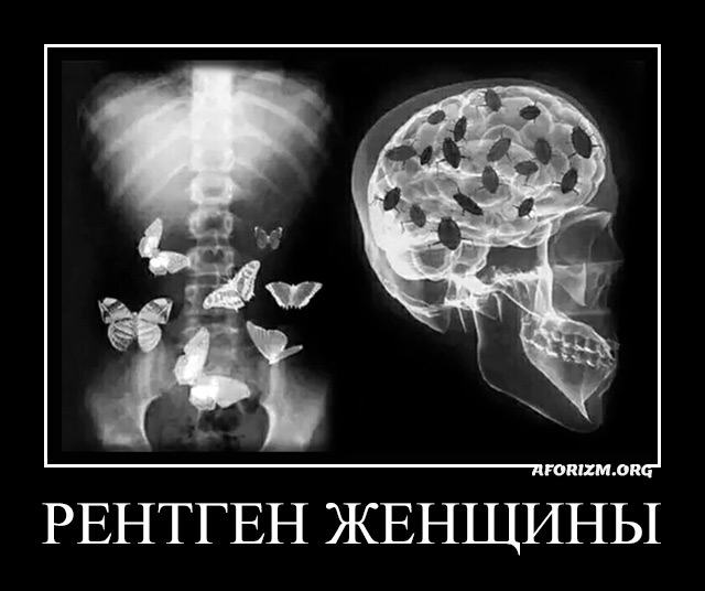 Рентген женщины.